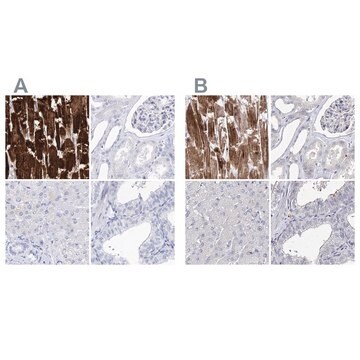Anti-MYOZ2 antibody produced in rabbit Prestige Antibodies&#174; Powered by Atlas Antibodies, affinity isolated antibody, buffered aqueous glycerol solution