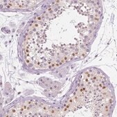 Anti-SOX9 antibody produced in rabbit Prestige Antibodies&#174; Powered by Atlas Antibodies, affinity isolated antibody, buffered aqueous glycerol solution