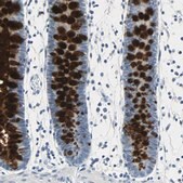 Anti-MUC4 antibody produced in rabbit Prestige Antibodies&#174; Powered by Atlas Antibodies, affinity isolated antibody, buffered aqueous glycerol solution