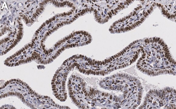 Anti-Progesterone Receptor Antibody, clone 1D2 ZooMAb&#174; Rabbit recombinant, expressed in HEK 293 cells