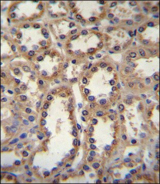 ANTI-GPC6 (C-TERM) antibody produced in rabbit IgG fraction of antiserum, buffered aqueous solution