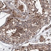 Anti-NISCH antibody produced in rabbit Prestige Antibodies&#174; Powered by Atlas Antibodies, affinity isolated antibody, buffered aqueous glycerol solution