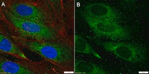 Anti-CARD8 Antibody, clone 1C23 ZooMAb&#174; Rabbit Monoclonal recombinant, expressed in HEK 293 cells