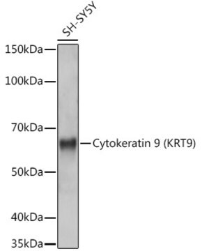 Anti-Cytokeratin 9 (KRT9) Antibody, clone 9A5H3, Rabbit Monoclonal