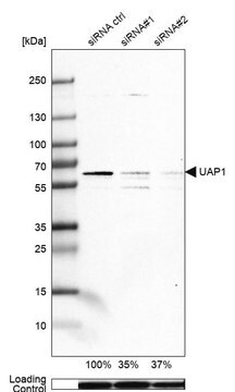 Anti-UAP1 antibody produced in rabbit Prestige Antibodies&#174; Powered by Atlas Antibodies, affinity isolated antibody, buffered aqueous glycerol solution