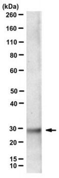 Anti-Mitochondrial ferritin/FTMT Antibody, clone C65-2