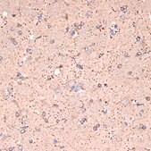 Anti-GABA transaminase (ABAT) Antibody, clone 10V1K9, Rabbit Monoclonal