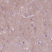 Anti-GABRB2 antibody produced in rabbit Prestige Antibodies&#174; Powered by Atlas Antibodies, affinity isolated antibody, buffered aqueous glycerol solution