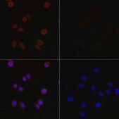 Anti-MAP1LC3B antibody produced in mouse