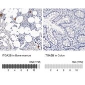 Anti-ITGA2B antibody produced in rabbit Prestige Antibodies&#174; Powered by Atlas Antibodies, affinity isolated antibody, buffered aqueous glycerol solution