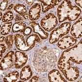 Anti-SDHB antibody produced in rabbit Prestige Antibodies&#174; Powered by Atlas Antibodies, affinity isolated antibody, buffered aqueous glycerol solution