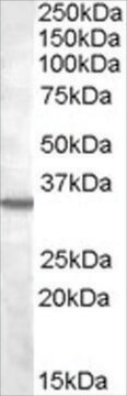 Anti-Bradykinin Receptor B1 antibody produced in goat affinity isolated antibody, buffered aqueous solution