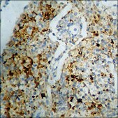 Anti-phospho-PKC-pan (pThr497) antibody produced in rabbit affinity isolated antibody