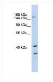 Anti-ABCC8 antibody produced in rabbit affinity isolated antibody