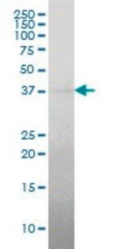 Monoclonal Anti-RCN2 antibody produced in mouse clone 2B12, ascites fluid
