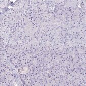 Anti-KCNQ2 antibody produced in rabbit Prestige Antibodies&#174; Powered by Atlas Antibodies, affinity isolated antibody, buffered aqueous glycerol solution