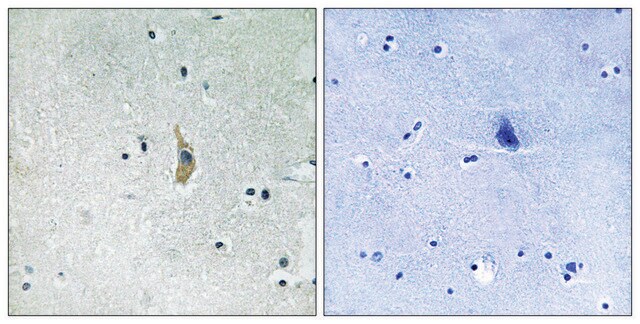 Anti-PSEN1 antibody produced in rabbit affinity isolated antibody