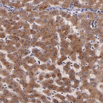 Anti-RBP4 antibody produced in rabbit Prestige Antibodies&#174; Powered by Atlas Antibodies, affinity isolated antibody, buffered aqueous glycerol solution