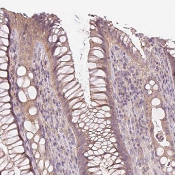 Anti-UBL3 antibody produced in rabbit Prestige Antibodies&#174; Powered by Atlas Antibodies, affinity isolated antibody, buffered aqueous glycerol solution