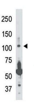 ANTI-NIK (CENTER) antibody produced in rabbit IgG fraction of antiserum, buffered aqueous solution