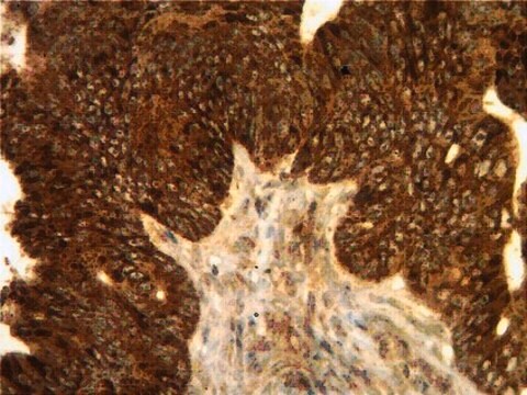 Anti-VPAC1 Antibody from rabbit, purified by affinity chromatography