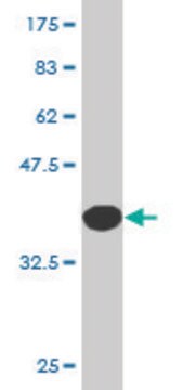 Monoclonal Anti-CSTA antibody produced in mouse clone 1A11, purified immunoglobulin, buffered aqueous solution