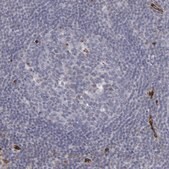 Anti-SLC9A3R2 antibody produced in rabbit Prestige Antibodies&#174; Powered by Atlas Antibodies, affinity isolated antibody, buffered aqueous glycerol solution