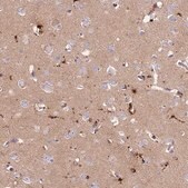 Anti-PRNP antibody produced in rabbit Prestige Antibodies&#174; Powered by Atlas Antibodies, affinity isolated antibody, buffered aqueous glycerol solution