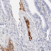 Anti-PLAT antibody produced in rabbit Prestige Antibodies&#174; Powered by Atlas Antibodies, affinity isolated antibody, buffered aqueous glycerol solution