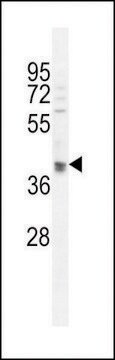 ANTI-OTUD3 (CENTER) antibody produced in rabbit affinity isolated antibody, buffered aqueous solution