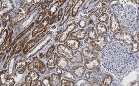 Anti-SDHB Antibody, clone 1H11 ZooMAb&#174; Rabbit Monoclonal recombinant, expressed in HEK 293 cells