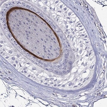 Anti-KRT40 antibody produced in rabbit Prestige Antibodies&#174; Powered by Atlas Antibodies, affinity isolated antibody, buffered aqueous glycerol solution
