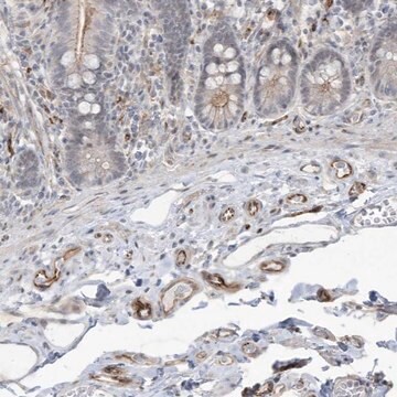 Anti-ADAMTSL3 antibody produced in rabbit Prestige Antibodies&#174; Powered by Atlas Antibodies, affinity isolated antibody, buffered aqueous glycerol solution