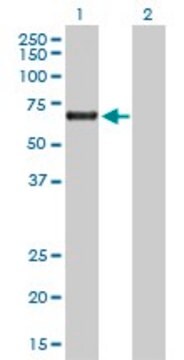 Anti-ACD antibody produced in rabbit purified immunoglobulin, buffered aqueous solution