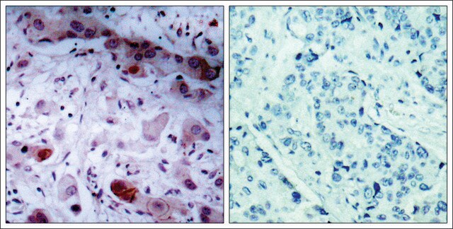 Anti-phospho-JAK1 (pTyr1022) antibody produced in rabbit affinity isolated antibody