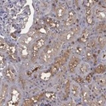 Anti-EFNA1 antibody produced in rabbit Prestige Antibodies&#174; Powered by Atlas Antibodies, affinity isolated antibody, buffered aqueous glycerol solution