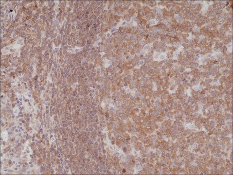 Anti-NF-kappa-B p105/p50 antibody, Rabbit Monoclonal recombinant, expressed in HEK 293 cells, clone RM299, purified immunoglobulin