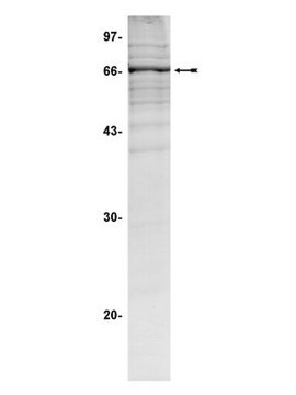 ROK&#945;/ROCK-II Protein, active, rat, 10 &#181;g Active, rat, N-terminal, His-tagged, fusion protein corresponding to amino acids 2-543 of rat ROKa/ROCK-II. For use in Kinase Assays.