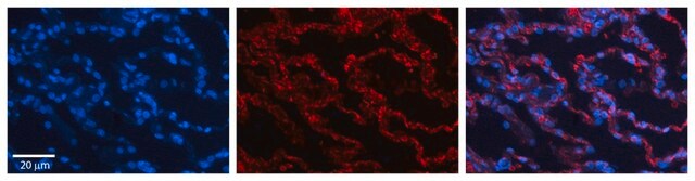 Anti-RPL13 antibody produced in rabbit affinity isolated antibody