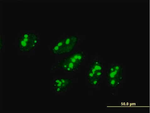 Anti-UTP3 antibody produced in mouse purified immunoglobulin, buffered aqueous solution