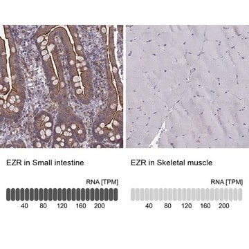 Monoclonal Anti-EZR antibody produced in mouse Prestige Antibodies&#174; Powered by Atlas Antibodies, clone CL2384, purified immunoglobulin, buffered aqueous glycerol solution