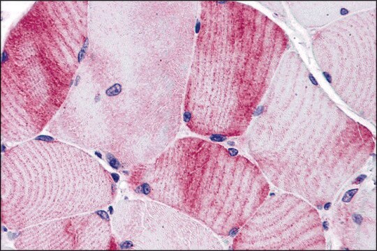 Anti-MYBPC1 antibody produced in rabbit affinity isolated antibody