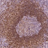 Anti-ALOX5 antibody produced in rabbit Prestige Antibodies&#174; Powered by Atlas Antibodies, affinity isolated antibody