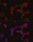Anti-IGF1R antibody produced in rabbit