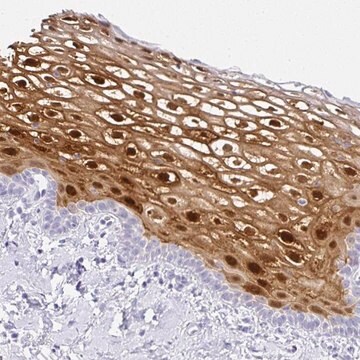 Anti-SERPINB3 antibody produced in rabbit Prestige Antibodies&#174; Powered by Atlas Antibodies, affinity isolated antibody, buffered aqueous glycerol solution