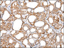 Anti-IL6 affinity isolated antibody