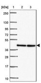 Anti-TWF2 antibody produced in rabbit Prestige Antibodies&#174; Powered by Atlas Antibodies, affinity isolated antibody, buffered aqueous glycerol solution