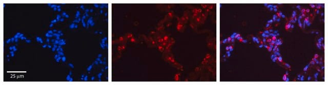 Anti-SFTPB antibody produced in rabbit affinity isolated antibody