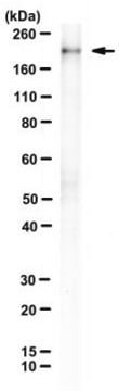 Anti-Munc13-1 Antibody, clone 11B-10G