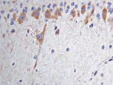 Anti-Nitrotyrosine Antibody, clone 2A8.2 clone 2A8.2, Chemicon&#174;, from mouse